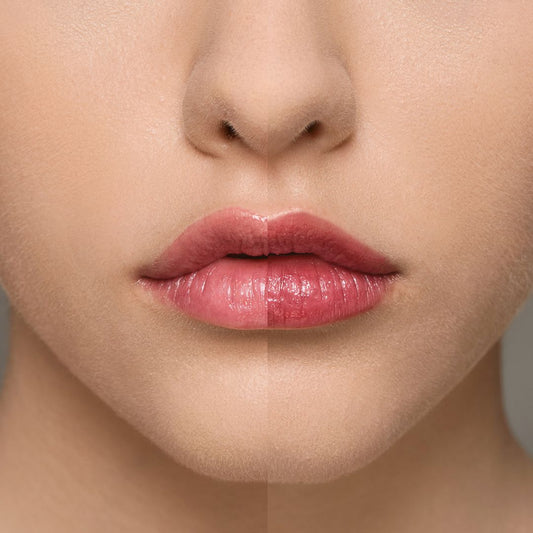 Supreme Lip Treatment - Raspberry — 4 g